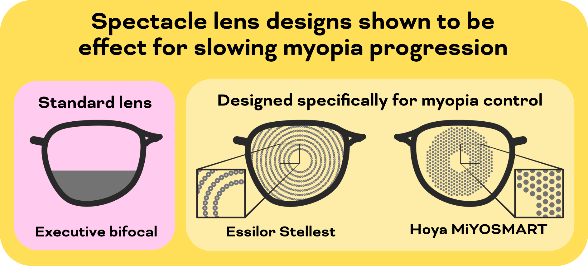 Glasses prescription nearsighted shop