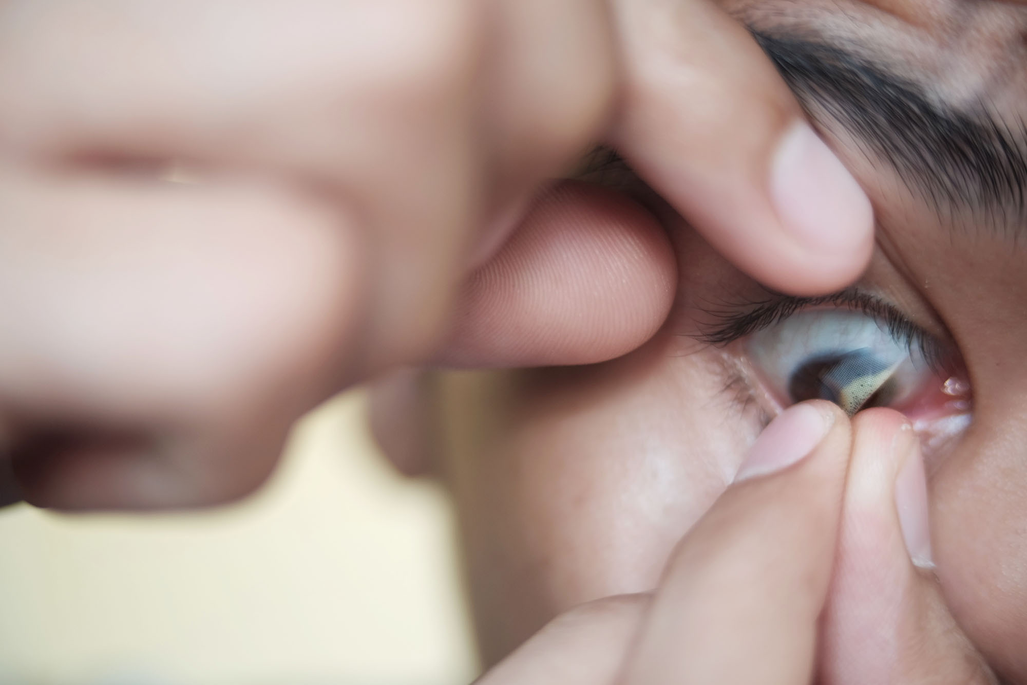 Safely remove a soft contact lens from your child's or someone else's eye 